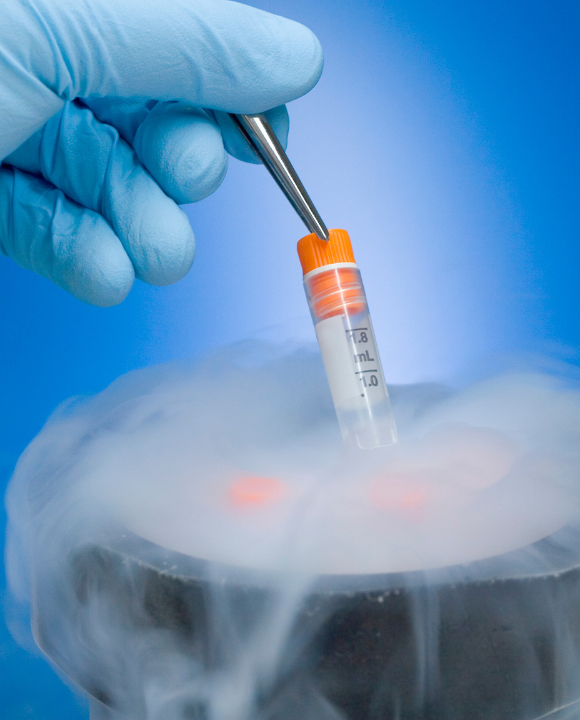 Semen Sample Concerns
