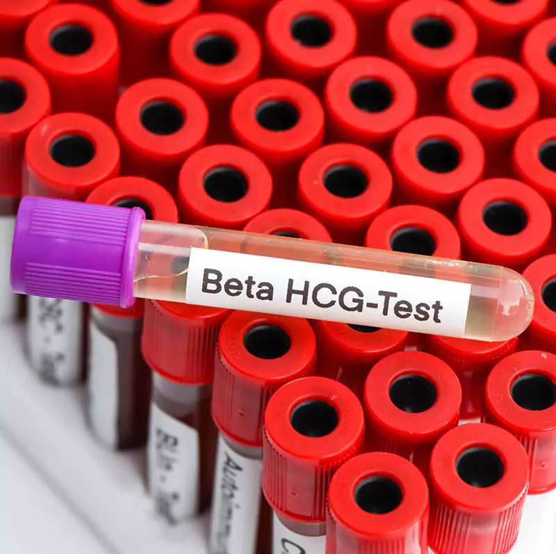 Beta-hcg