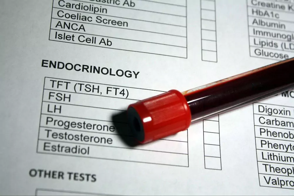 Endometrium Preparation